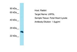 LRP5L Rabbit anti-Human, Polyclonal, Novus Biologicals 0.1ml; Unconjugated:Antibodies,
